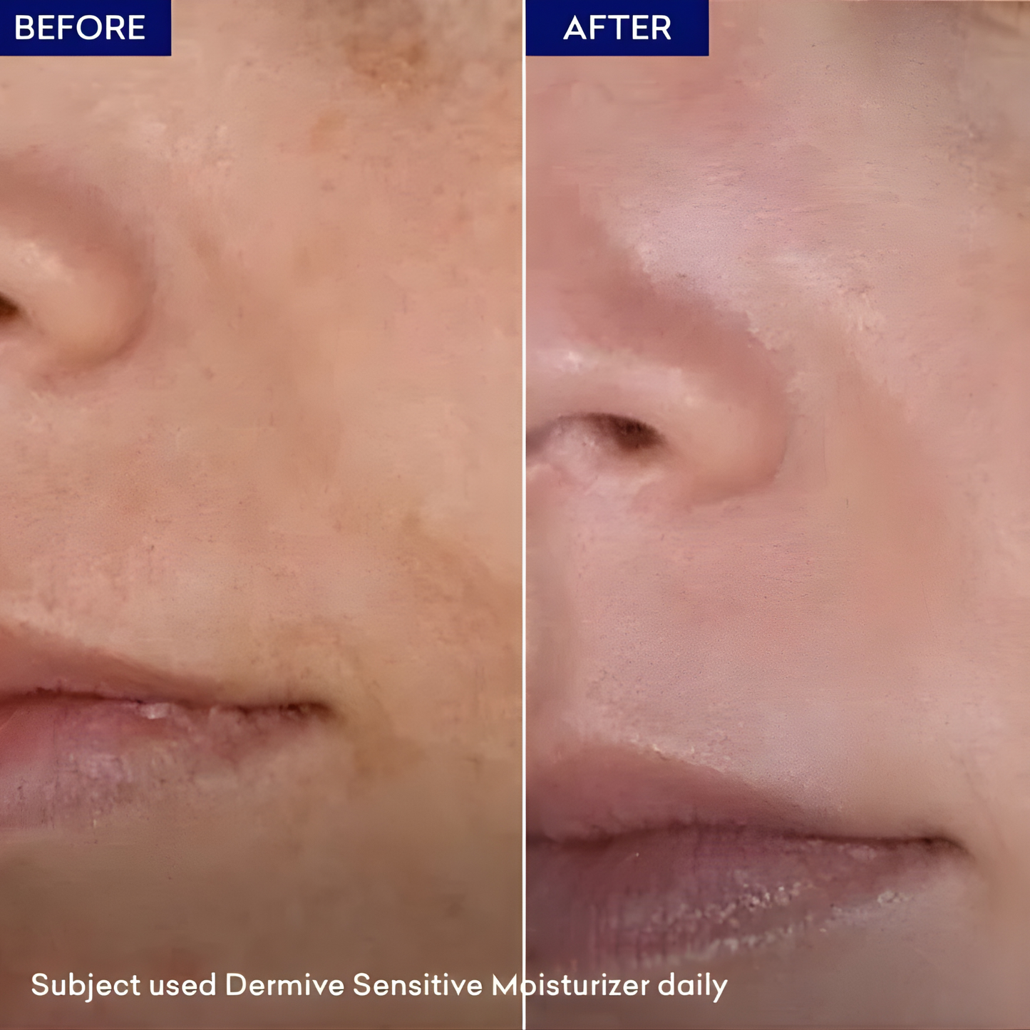 Dermive Sensitive Moisturizer | Soothing Hydration for Dry & Irritated Skin